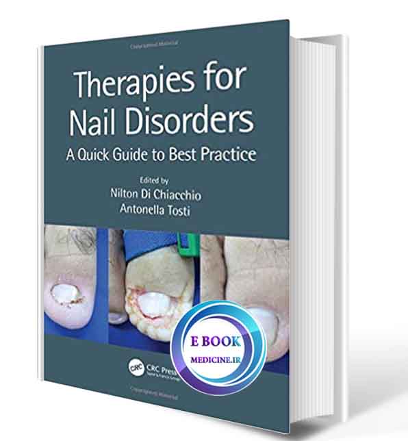 دانلود کتابTherapies for Nail Disorders: A Quick Guide to Best Practice 2020(Original PDF)